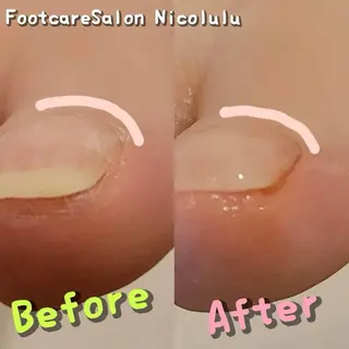足トラブル専門 ニコルル金沢のエステ・リラクイメージ