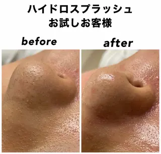 ネイル・エステサロン UILANIのネイルデザイン