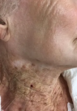 肌質改善 KALANCHOEのエステ・リラクイメージ