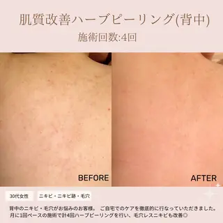 肌質改善専門サロン Bellmi/心斎橋のエステ・リラクイメージ