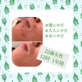 ミディアム カラー パーマ ヘアアレンジ メンズ キッズ ネイル マツエク・マツパ ニキビ・肌質改善専門 ♡人生が変わるサロンのエステ・リラクイメージ