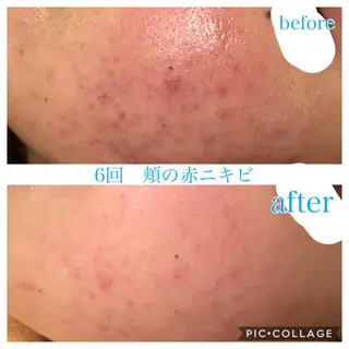 セミロング カラー パーマ ヘアアレンジ メンズ キッズ ネイル マツエク・マツパ EnsorClair 代表　野口真央のエステ・リラクイメージ