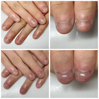 ネイル ネイルサロン アリュームのネイルデザイン