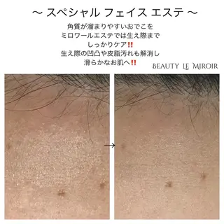 ビューティー ミロワールのエステ・リラクイメージ