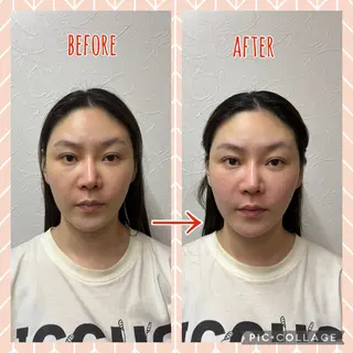 NO.10 整骨院のエステ・リラクイメージ