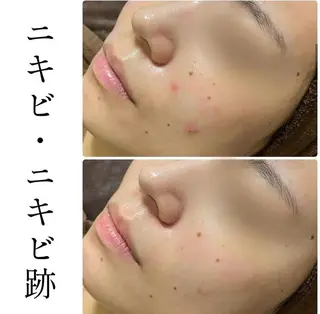 ハーブピーリング専門 BIOPLUS+川崎のエステ・リラクイメージ