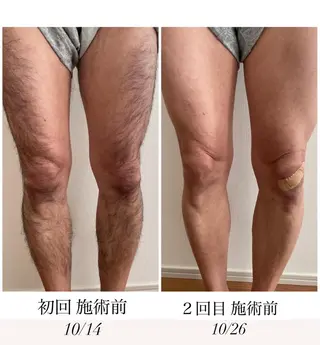 エステサロン Mi-mi.iのエステ・リラクイメージ