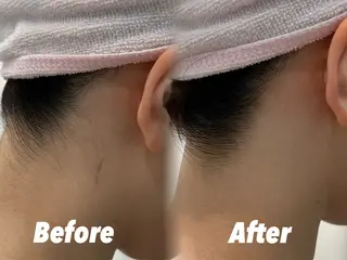 🫧美しい素肌へ🫧 今成柚乃のその他イメージ