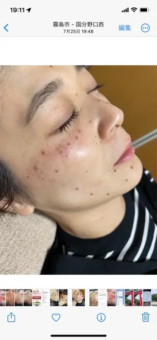 美容鍼・脱毛サロン CURAIMのエステ・リラクイメージ
