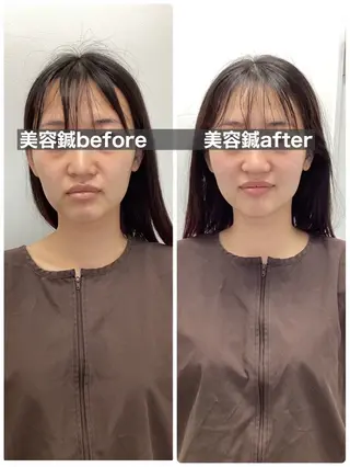 美容鍼灸×小顔整体♡ ハリサロンドオフ堺東のその他イメージ