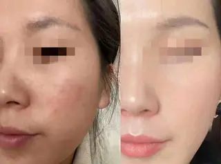 ネイル aliaハーブ水光店 エステティシャン募集のエステ・リラクイメージ