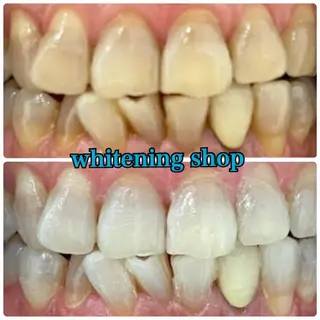 ホワイトニングショップ津店所属・ホワイトニング ショップ津店のその他イメージ