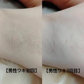 みんなの脱毛 TSURURINのエステ・リラクイメージ