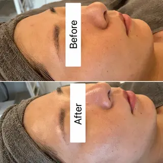 Blue Moon 【ブルームーン】のエステ・リラクイメージ