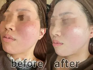 浮腫|肩こり|張り 日々の疲れを解消★のエステ・リラクイメージ