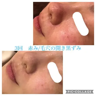 ロング カラー パーマ ヘアアレンジ キッズ ネイル マツエク・マツパ EnsorClair 代表 野口真央のエステ・リラクイメージ