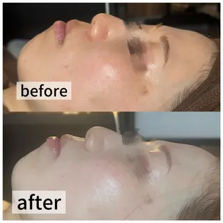 浮腫|肩こり|張り 日々の疲れを解消★のエステ・リラクイメージ