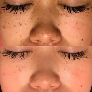 Morphome所属・【Morphome】 ﾓﾙﾌｫﾑのエステ・リラクイメージ