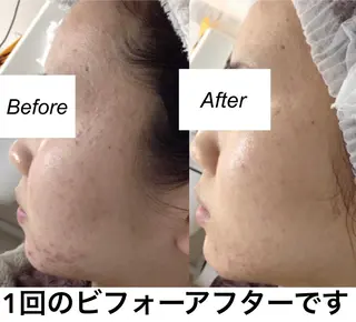 ミディアム カラー パーマ キッズ ネイル マツエク・マツパ 都度払い肌質改善 &脱毛Blancheのエステ・リラクイメージ