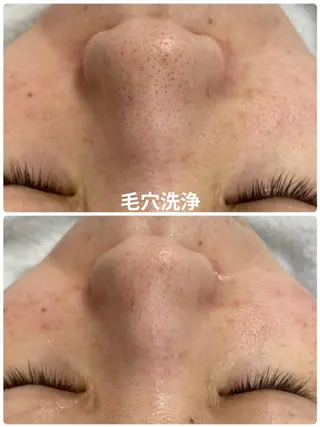 メンズ えだ すがこのエステ・リラクイメージ