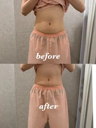 メンズ 腸活サポート みなみののエステ・リラクイメージ