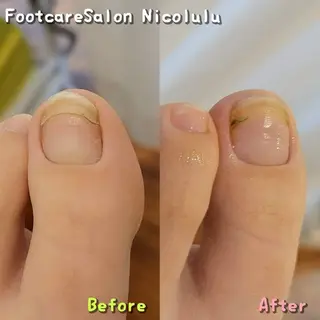 メンズ 足トラブル専門 ニコルル金沢のエステ・リラクイメージ