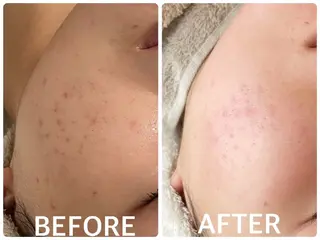 ハーブピーリング横浜 肌質改善専門店のその他イメージ