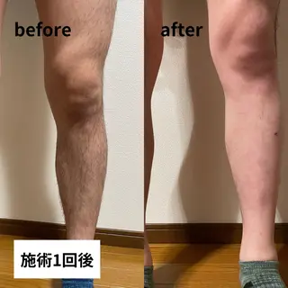 メンズ メンズ脱毛サロン 上岡　翼のエステ・リラクイメージ