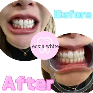 セルフホワイトニング エクシア前橋店のその他イメージ