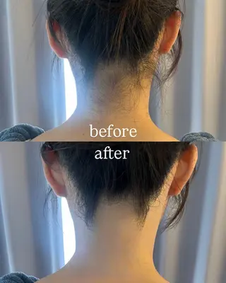 うなじ脱毛/美肌脱毛 LABELのエステ・リラクイメージ