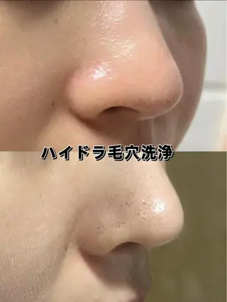 美BELLO 池袋のエステ・リラクイメージ