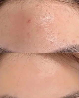 愛維美水光美肌専門店所属・愛維美水光美肌専門店 メンズレディースokのエステ・リラクイメージ