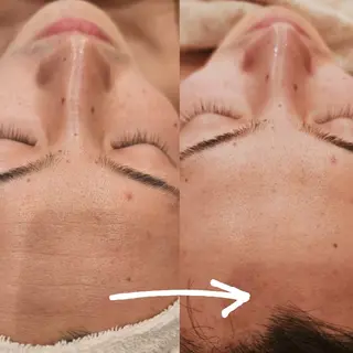 ベル チェリカ 三城のエステ・リラクイメージ