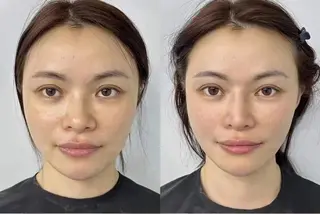 ネイル aliaハーブ水光店 エステティシャン募集のエステ・リラクイメージ