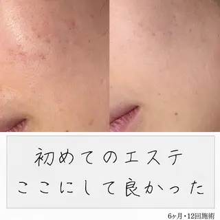 ニキビ経験者が施術 する専門サロン🌻のエステ・リラクイメージ