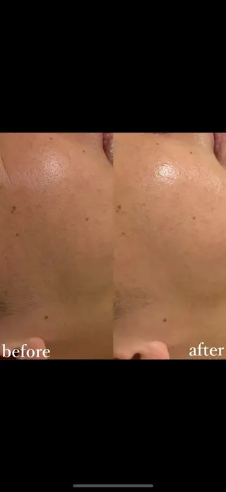 女性専門お顔剃り sunraineのエステ・リラクイメージ