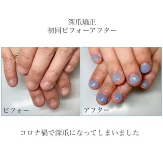 ネイル ネイルサロン アリュームのネイルデザイン