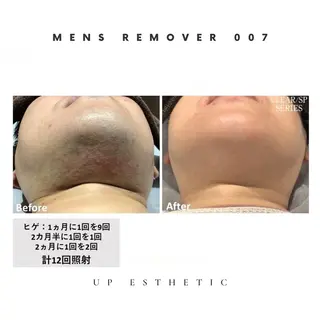 メンズ 韓国肌管理 ウプエステティックのエステ・リラクイメージ