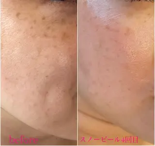 〚博多〛フィユ 水江のマツエク・マツパデザイン