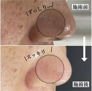 毛穴専門サロン MUKUムクのエステ・リラクイメージ
