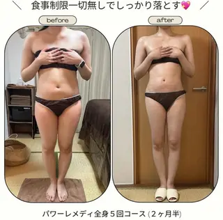 《本気痩せ×疲労改善 》  BILOOPのエステ・リラクイメージ