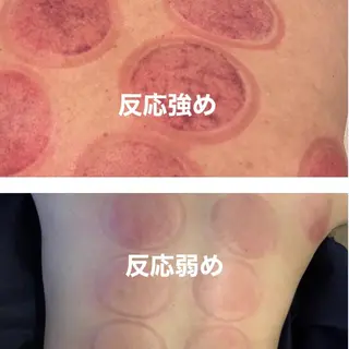 白金台よもぎ蒸し メテオアヴェニューのエステ・リラクイメージ