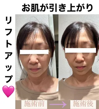 脱毛&美容サロン BLUESEAのエステ・リラクイメージ