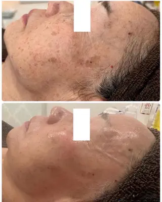 Meow！～トラブル肌専門ピーリング＆脱毛サロン～所属・トラブル肌改善🏥 Meow！🫧🫧のその他イメージ