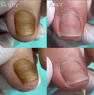 巻き爪アカデミー 溝の口のネイルデザイン