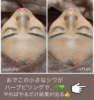 WHITE AQUA 🌼柏店のエステ・リラクイメージ