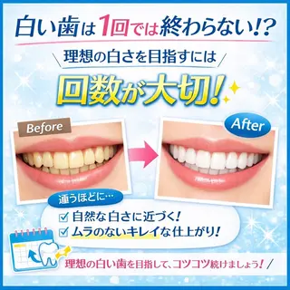 ホワイトニング ショップ船橋店🦷のエステ・リラクイメージ