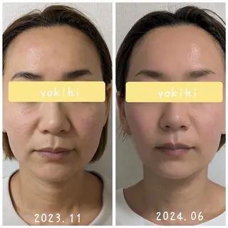 結果が出るスキンケア 肌質改善/まつパのエステ・リラクイメージ