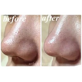 結果重視｜毛穴エステ ｜友綱理恵のエステ・リラクイメージ