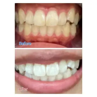 M渋谷 ホワイトニングのエステ・リラクイメージ